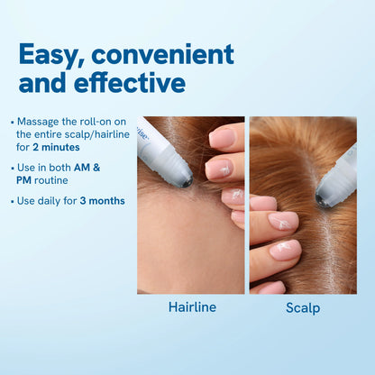 The Remedy Co.™ Hair Growth Serum Roll On